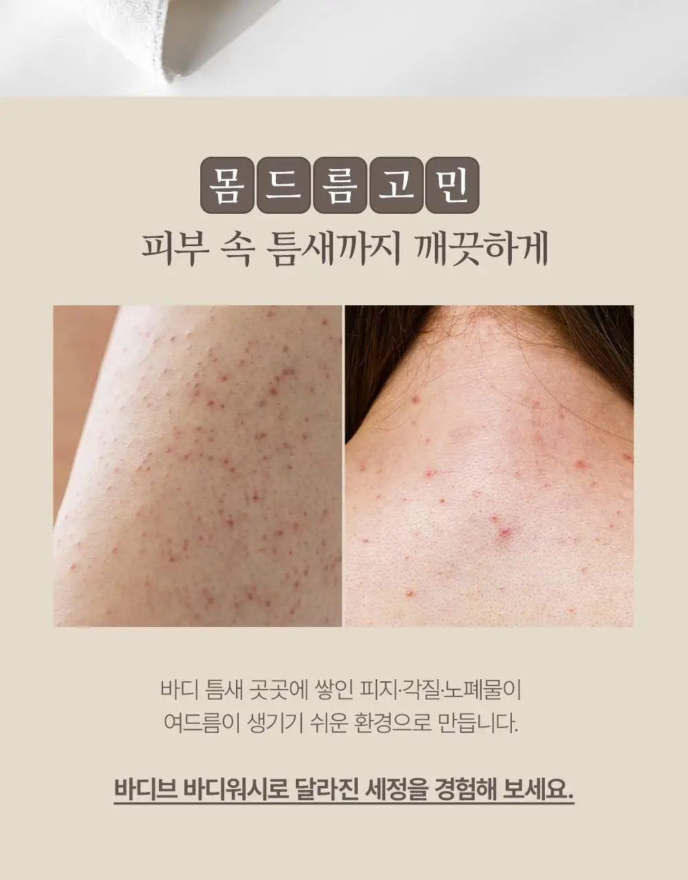 [대용량] 바디브 약산성 바디워시 [여드름기능성/등드름] 1000ml 3종 택1 상세페이지 2